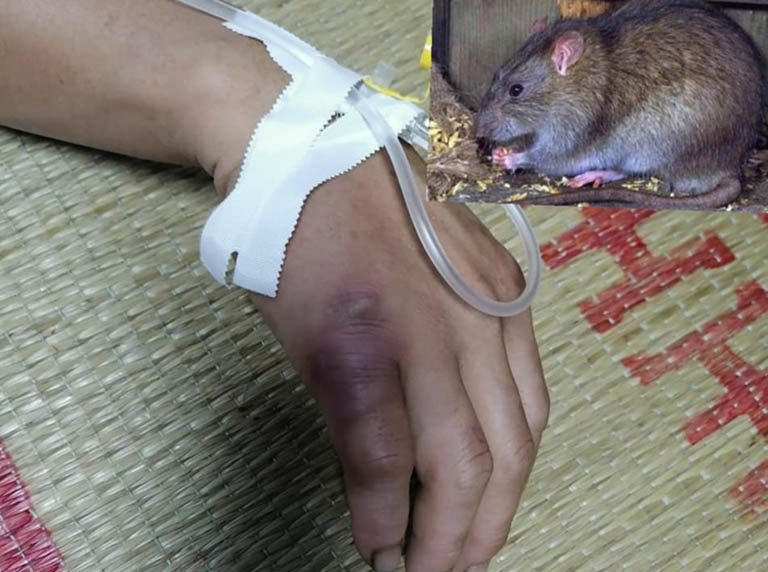 Rat syndrome