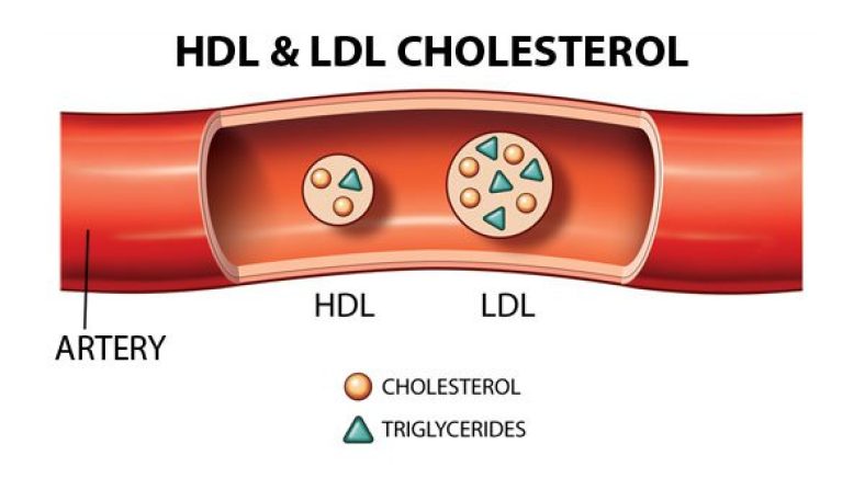 Role of Beneficial HDL-C Lipids
