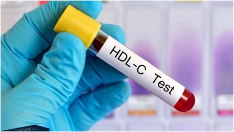 What is HDL Cholesterol Level?